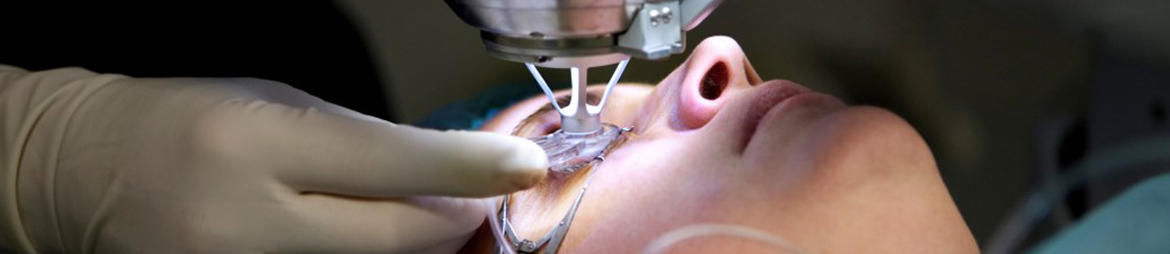 laser cataract surgery